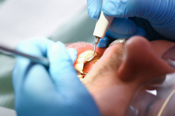 Best Urgent Dental Care for Toothache in Bronson, MI