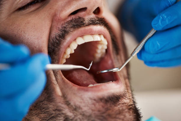 Best Holiday Emergency Dentist in Bronson, MI